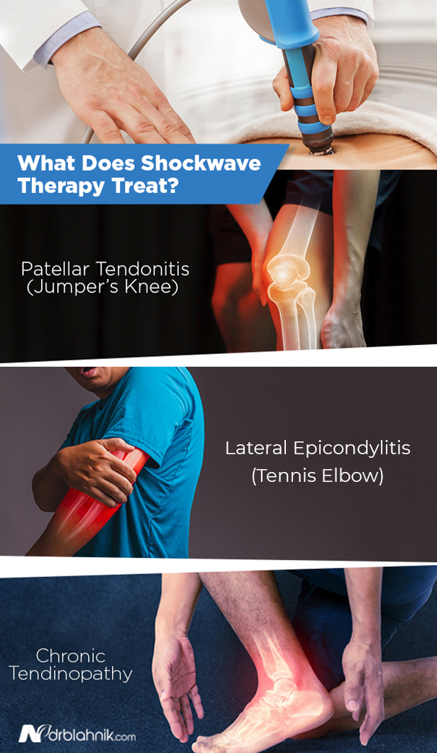 What is Shockwave Therapy and How Does It Help People?